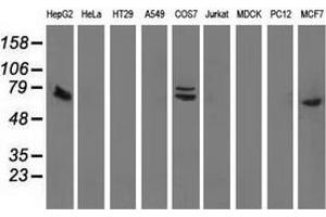 Western blot analysis of extracts (35 µg) from 9 different cell lines by using anti-SAMHD1 monoclonal antibody. (SAMHD1 anticorps)