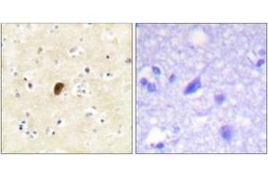 Immunohistochemistry analysis of paraffin-embedded human brain, using GluR4 (Phospho-Ser862) Antibody. (GRIA4 anticorps  (pSer862))