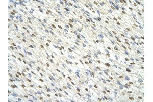 Rabbit Anti-DAZAP1 antibody         Paraffin Embedded Tissue:  Human Heart    cell Cellular Data:  cardiac cell    Antibody Concentration:  4.