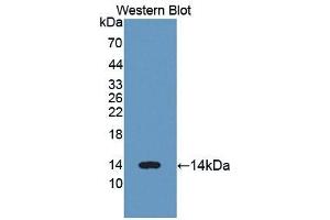 Detection of Recombinant LZM, Human using Polyclonal Antibody to Lysozyme (LZM) (LYZ anticorps  (AA 24-144))