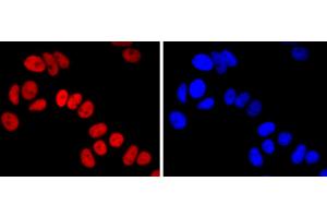 MCF-7 cells were stained with FOXA1 (5F7) Monoclonal Antibody  at 1:200 dilution, incubated overnight at 4C, followed by secondary antibody incubation, DAPI staining of the nuclei and detection. (FOXA1 anticorps)
