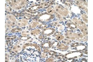 Presenilin 2 antibody was used for immunohistochemistry at a concentration of 4-8 ug/ml to stain Epithelial cells of renal tubule (arrows) in Human Kidney.