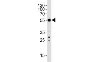 Western blot analysis of lysate from SH-SY5Y cell line using APG5/ ATG5 antibody at 1:1000. (ATG5 anticorps  (AA 1-30))