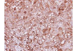 IHC-P Image Immunohistochemical analysis of paraffin-embedded DU145 xenograft, using Angiopoietin 4, antibody at 1:100 dilution. (Angiopoietin 4 anticorps  (N-Term))