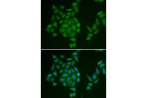 Immunofluorescence analysis of HeLa cells using AMPD3 antibody (ABIN6290008). (AMPD3 anticorps)