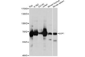 Western blot analysis of extracts of various cell lines, using LCP1 antibody (ABIN1876741) at 1:1000 dilution. (LCP1 anticorps)