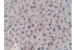 Detection of GSTM1 in Mouse Liver Tissue using Polyclonal Antibody to Glutathione S Transferase Mu 1 (GSTM1)