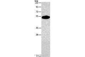 Western blot analysis of Mouse heart tissue, using SMAD9 Polyclonal Antibody at dilution of 1:290