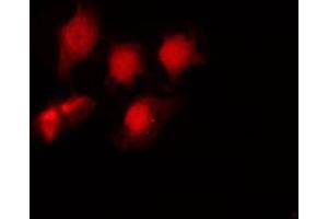 ABIN6267694 staining NIH-3T3 by IF/ICC. (HDAC6 anticorps  (pSer22))