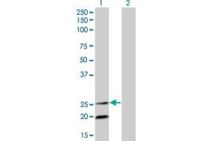 Western Blot analysis of IL6 expression in transfected 293T cell line by IL6 monoclonal antibody (M04), clone 3G6. (IL-6 anticorps  (AA 29-212))