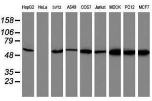 Image no. 1 for anti-V-Akt Murine Thymoma Viral Oncogene Homolog 1 (AKT1) antibody (ABIN1496557) (AKT1 anticorps)
