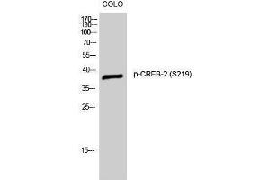 Western Blotting (WB) image for anti-Activating Transcription Factor 4 (Tax-Responsive Enhancer Element B67) (ATF4) (pSer219) antibody (ABIN3182392) (ATF4 anticorps  (pSer219))