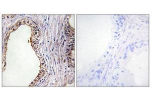 Immunohistochemistry (IHC) image for anti-Lecithin Retinol Acyltransferase (Phosphatidylcholine--Retinol O-Acyltransferase) (LRAT) (Internal Region) antibody (ABIN1849061) (LRAT anticorps  (Internal Region))