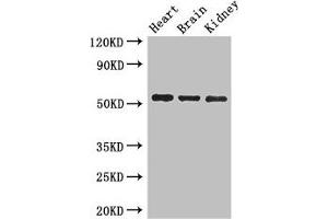 Western Blot Positive WB detected in: Mouse heart tissue, Mouse brain tissue, Mouse kidney tissue All lanes: SH3BP5 antibody at 3 μg/mL Secondary Goat polyclonal to rabbit IgG at 1/50000 dilution Predicted band size: 51, 33 kDa Observed band size: 51 kDa (SH3BP5 anticorps  (AA 49-455))