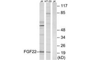 Western blot analysis of extracts from Jurkat/HT-29 cells, using FGF22 Antibody. (FGF22 anticorps  (AA 71-120))