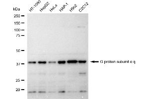 Western blotting analysis using G protein subunit alpha q antibody (ABIN7800932).
