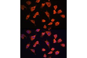 Immunofluorescence analysis of L929 cells using PFDN5 Rabbit pAb (ABIN1681328, ABIN3018415, ABIN3018416 and ABIN6220463) at dilution of 1:100 (40x lens). (PFDN5 anticorps  (AA 1-154))