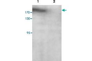 Western blot analysis of SK-OV-3 cell lysate with PARP14 polyclonal antibody  at 1 : 200 dilution. (PARP14 anticorps  (C-Term))
