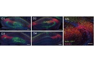 Representative confocal serial sections of hippocampus infected with AAV9/hSyn-Cre & AAV9/EF1α-DIO-EGFP (green) in dCA2 and stained with RGS14 ((ABIN1304934), 1:500, red).