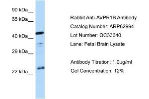 Western Blotting (WB) image for anti-Arginine Vasopressin Receptor 1B (AVPR1B) (C-Term) antibody (ABIN2774358) (AVPR1B anticorps  (C-Term))