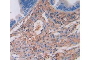 IHC-P analysis of Mouse Uterus Tissue, with DAB staining. (SERPINA3 anticorps  (AA 23-253))