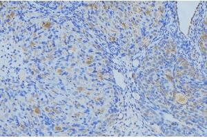 ABIN6269003 at 1/100 staining Human uterus tissue by IHC-P. (COL3A1 anticorps  (N-Term))