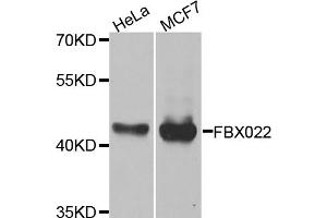 Western blot analysis of extracts of various cell lines, using FBXO22 antibody (ABIN5974568) at 1/1000 dilution. (FBXO22 anticorps)