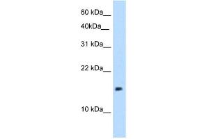 WB Suggested Anti-PAGE1 Antibody Titration:  5. (PAGE1 anticorps  (Middle Region))