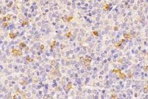 Immunohistochemistry analysis of paraffin-embedded mouse pituitary gland using GPR120 (ABIN7074942) at dilution of 1: 2000