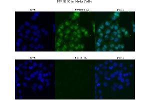 Sample Type :  HeLa   Primary Antibody Dilution:  4 ug/ml   Secondary Antibody :  Anti-rabbit Alexa 546   Secondary Antibody Dilution:  2 ug/ml   Gene Name :  PPP1R10 (PPP1R10 anticorps  (N-Term))