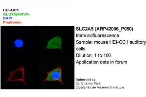 Image no. 2 for anti-Solute Carrier Family 2 (Facilitated Glucose/fructose Transporter), Member 5 (SLC2A5) (Middle Region) antibody (ABIN2777140) (SLC2A5 anticorps  (Middle Region))