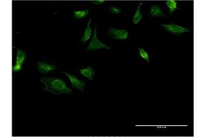 Immunofluorescence of monoclonal antibody to ITGA4 on HeLa cell. (ITGA4 anticorps  (AA 98-207))
