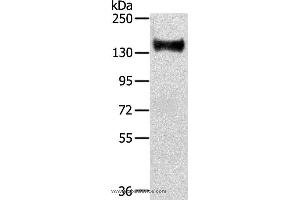 Western blot analysis of Mouse brain tissue, using RASAL2 Polyclonal Antibody at dilution of 1:350 (RASAL2 anticorps)