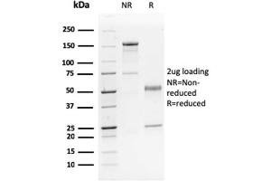 SDS-PAGE Analysis Purified p63 Mouse Monoclonal Antibody (TP63/2428). (p63 anticorps)