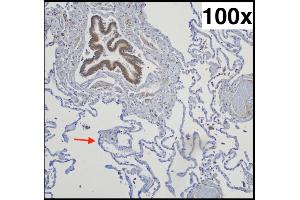 Typical pulmonal findings in AQP-5 (aquaporin-5) immunohistochemistry (right lower lobe, 73-year-old woman with chronic emphysema): Strongly positive bronchial epithelium (upper left corner) next to negative pneumocytes type I (exemplary marked with an arrow) Source: PMID34181078 (Aquaporin 5 anticorps  (AA 201-265) (Biotin))