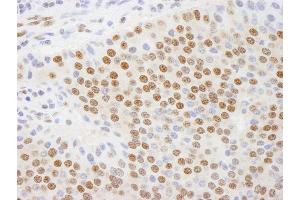 Immunohistochemistry (IHC) image for anti-C-terminal Binding Protein 1 (CTBP1) (AA 400-440) antibody (ABIN7448499) (CTBP1 anticorps  (AA 400-440))