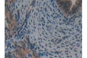 Detection of GSTk1 in Mouse Uterus Tissue using Polyclonal Antibody to Glutathione S Transferase Kappa 1 (GSTk1)