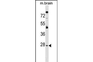 AQP1 Antibody (C-term) (ABIN1536913 and ABIN2849410) western blot analysis in mouse brain tissue lysates (35 μg/lane). (Aquaporin 1 anticorps  (C-Term))