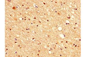 IHC image of ABIN7175396 diluted at 1:500 and staining in paraffin-embedded human brain tissue performed on a Leica BondTM system. (VASH1 anticorps  (AA 1-204))