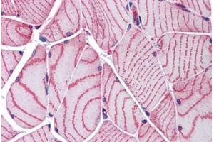 Human Skeletal Muscle: Formalin-Fixed, Paraffin-Embedded (FFPE) (ACTN2 anticorps  (AA 215-500))