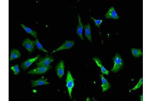 Immunofluorescent analysis of Hela cells using ABIN7144268 at dilution of 1:100 and Alexa Fluor 488-congugated AffiniPure Goat Anti-Rabbit IgG(H+L)