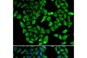 Immunofluorescence analysis of HeLa cells using ASIP Polyclonal Antibody (ASIP anticorps)