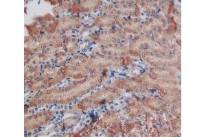 Used in DAB staining on fromalin fixed paraffin- embedded kidney tissue