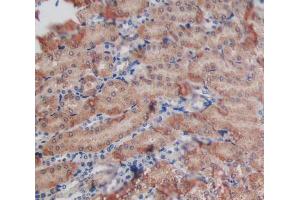 Used in DAB staining on fromalin fixed paraffin- embedded kidney tissue (GALNS anticorps  (AA 168-377))