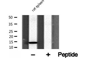 Western blot analysis of RPL31 Antibody expression in rat spleen tissue lysates. (RPL31 anticorps  (Internal Region))