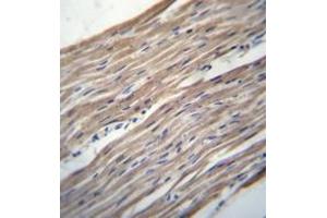 Immunohistochemistry analysis in formalin fixed and paraffin embedded human heart tissue reacted with HRC / HCR Antibody (Center) followed which was peroxidase conjugated to the secondary antibody and followed by DAB staining.