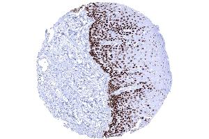 In the esophagus a strong p63 staining occurs squamous epithelial cells