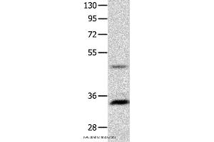 Western blot analysis of Mouse intestinum tenue tissue  , using MC1R Polyclonal Antibody at dilution of 1:1450 (MC1 Receptor anticorps)