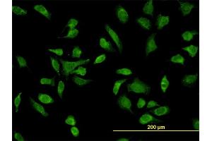 Immunofluorescence of monoclonal antibody to SH3BP5 on HeLa cell.