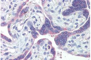 Placenta, Human: Formalin-Fixed, Paraffin-Embedded (FFPE) (PDIA3 anticorps)